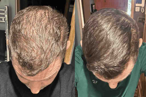 Avant / Après de Julien D