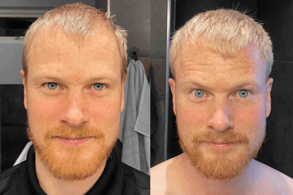 Avant / Après de Thomas G