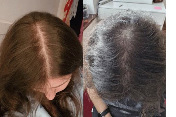 Avant / Après de Manon K