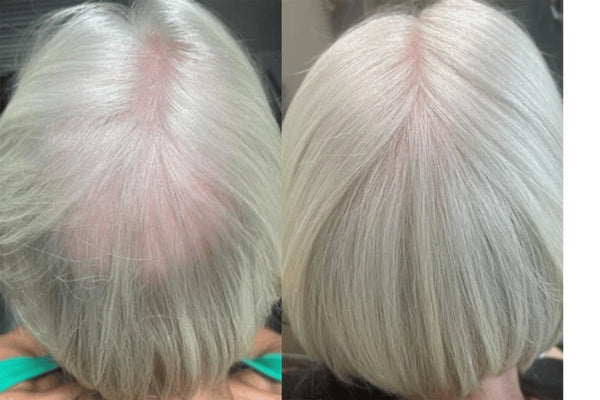 Avant / Après de Laura E